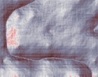 flexible endoskope